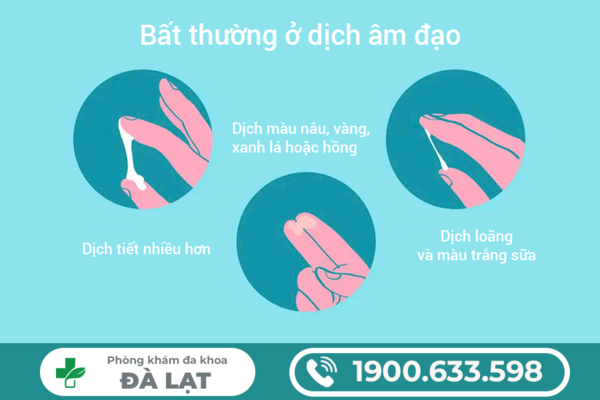 Hình ảnh minh họa